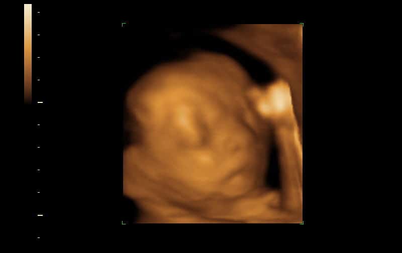 3D ultrasound of a baby at about 21 weeks