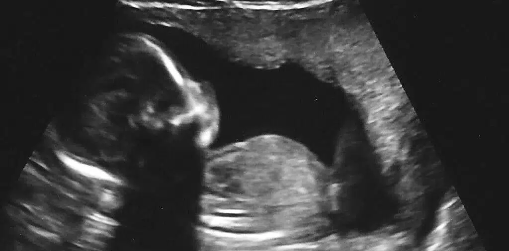 baby in ultrasound